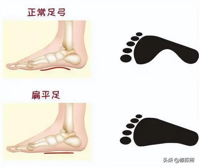 夏天不建议买这3种鞋累脚、滂臭还有毒！别乱跟风纯属浪费钱(图8)